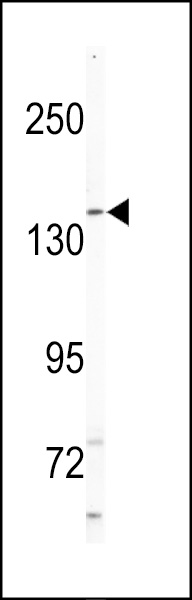 WB - NIK Antibody (C-term) AP8004a